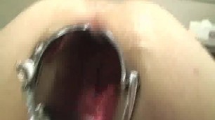 XXL anal gaping and brutal fist fucking